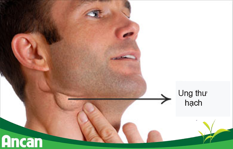 5 loại ung thư thường gặp ở người lớn tuổi 4