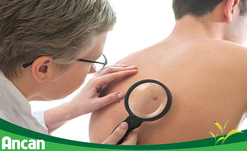 Các dấu hiệu ung thư sớm không nên bỏ qua 4