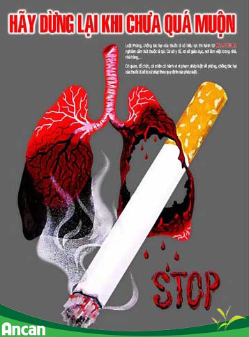 Điều trị ung thư sớm đừng để quá muộn 2