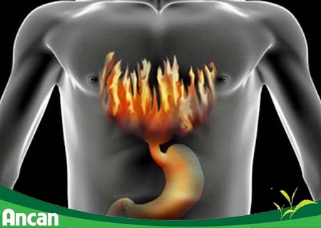 Ợ nóng - nguy cơ cảnh báo ung thư thực quản 2