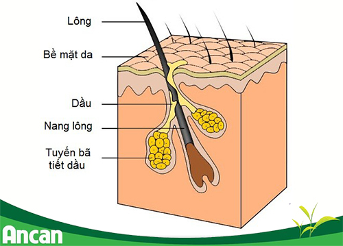 u-ba-dau-la-gi-nguyen-nhan-gay-u-ba-dau-3