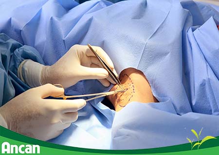 cach-chua-tri-u-ba-dau-3