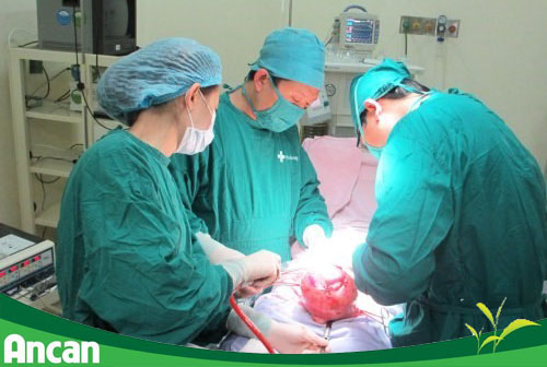 Phân loại u mỡ và cách điều trị u mỡ 3