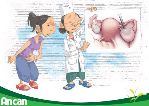 dau-hieu-nhan-biet-u-nang-buong-trung-3