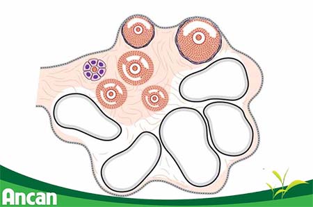 U nang buồng trứng có nguy hiểm không 1