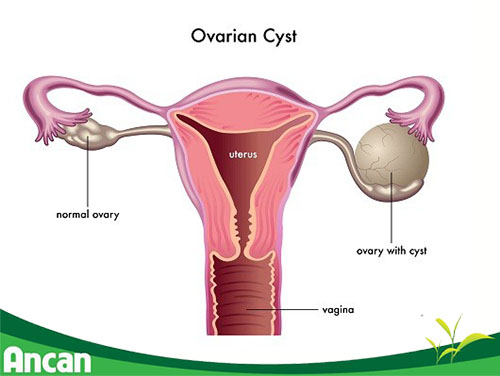 U nang buồng trứng phát triển qua những giai đoạn nào? 1