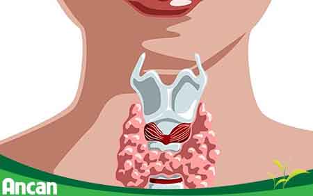 Bệnh k giáp thể nhú