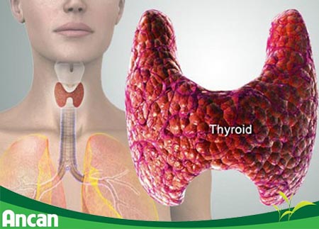 Bệnh u tuyến giáp là gì 1