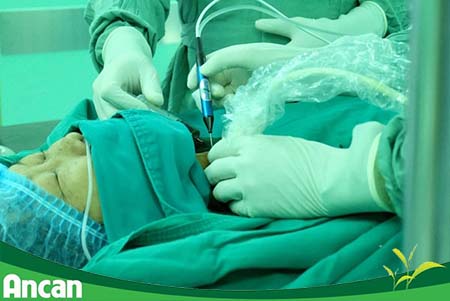 Cách điều trị u tuyến giáp 2