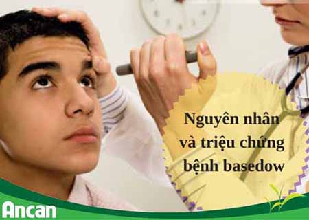 Nguyên nhân gây bệnh basedow