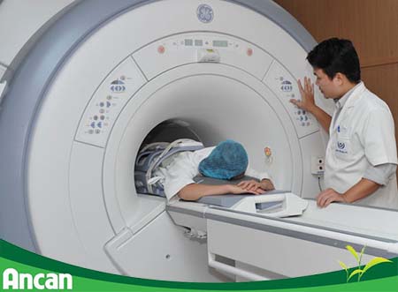 Nguyên nhân gây u tuyến giáp 2