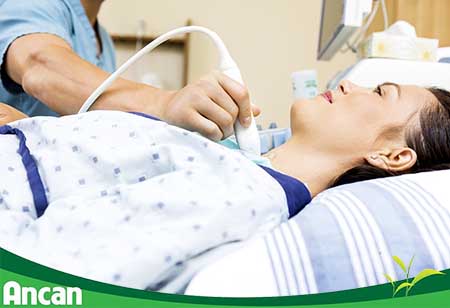 Nguyên nhân và triệu chứng nhân tuyến giáp 4