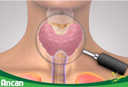 nhân tuyến giáp là gì 1