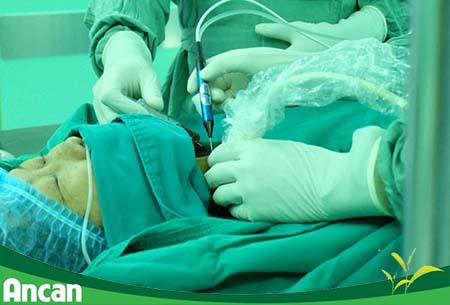 nhân tuyến giáp là gì 4