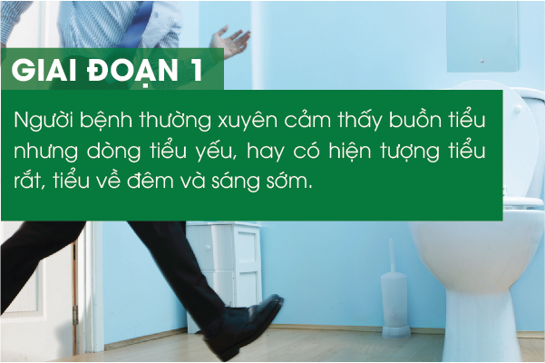 Các giai đoạn phát triển của bệnh u xơ tiền liệt tuyến1