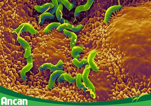 Thủ phạm gây ung thư dạ dày ở 70% người Việt 2