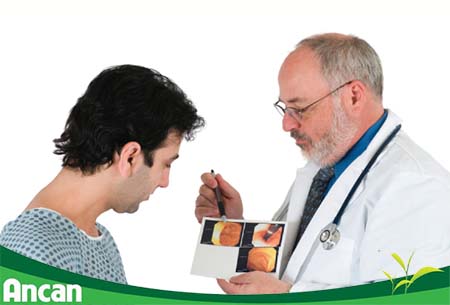 Ung thư đại tràng sống được bao lâu 3