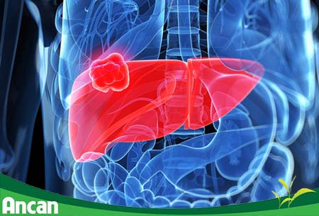 Bệnh ung thư gan có lây không 2