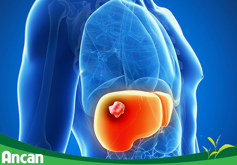 Các biện pháp phòng tránh ung thư gan 1