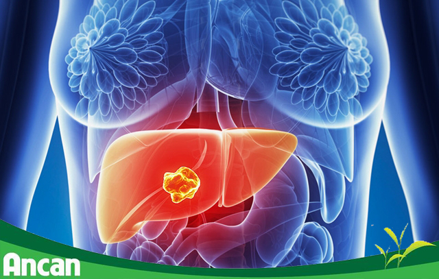 Các phương pháp điều trị ung thư gan hiện nay 1