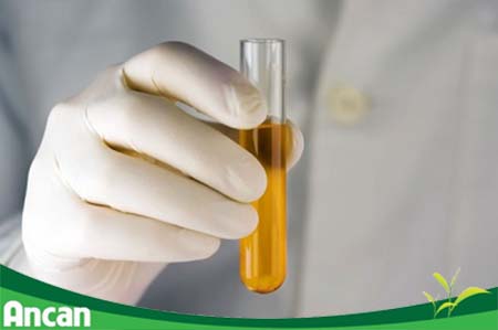 Dấu hiệu ung thư gan giai đoạn đầu và cách điều trị 3