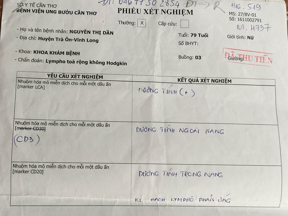 Người phụ nữ thoát án tử ung thư hạch ác tính 1