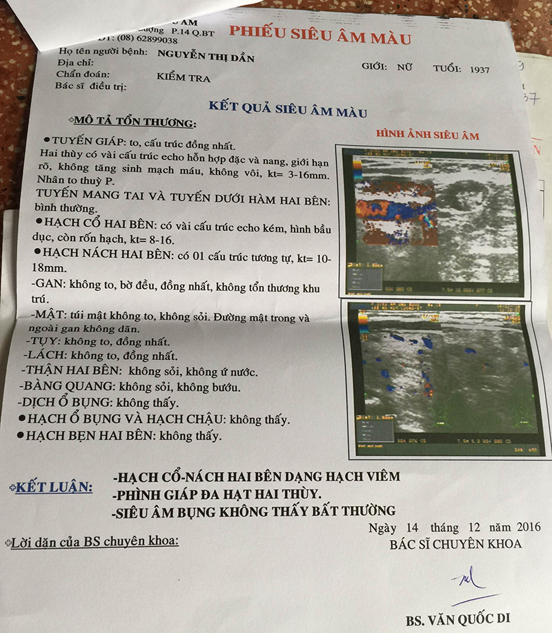 Người phụ nữ thoát án tử ung thư hạch ác tính 3