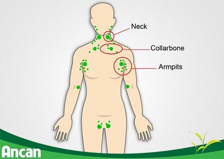 Chăm Sóc và Hỗ Trợ Bệnh Nhân