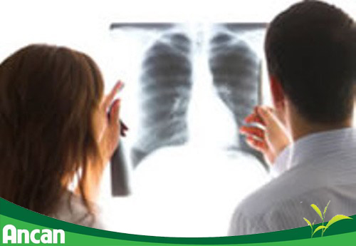 Các phương pháp chẩn đoán bệnh ung thư phổi 1