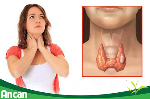 dấu hiệu ung thư tuyến giáp 1