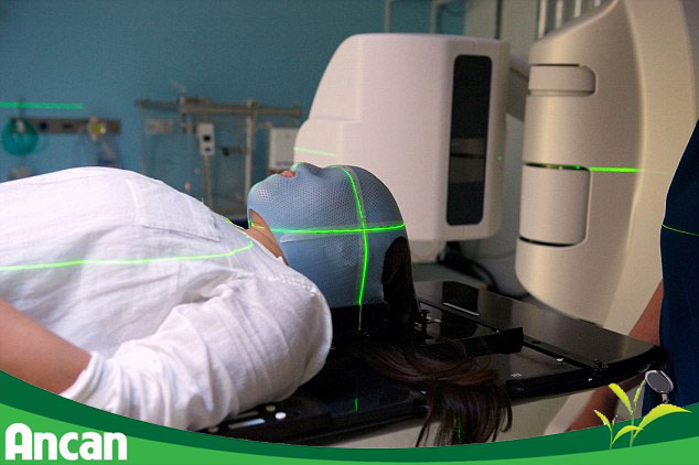 cách điều trị ung thư tuyến giáp 2