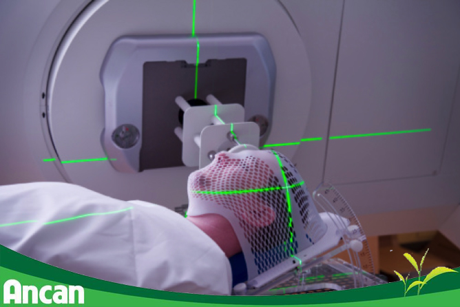 Các phương pháp điều trị ung thư vòm họng hiện nay 1