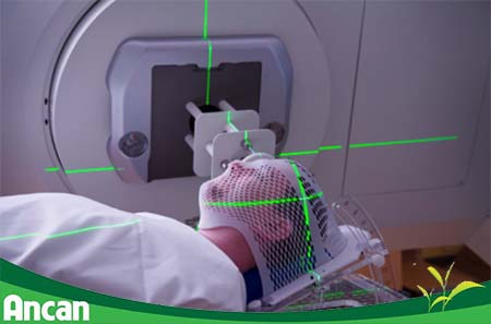 kien-thuc-chung-ve-ung-thu-vom-hong-5