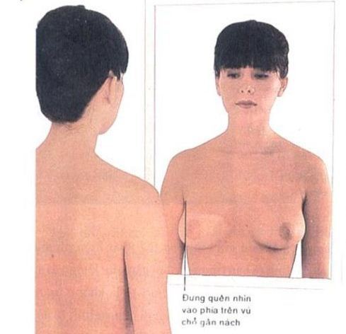 Cách tự khám ngực để phát hiện ung thư vú 1