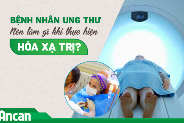 Bệnh nhân ung thư nên làm gì khi thực hiện hóa xạ trị?