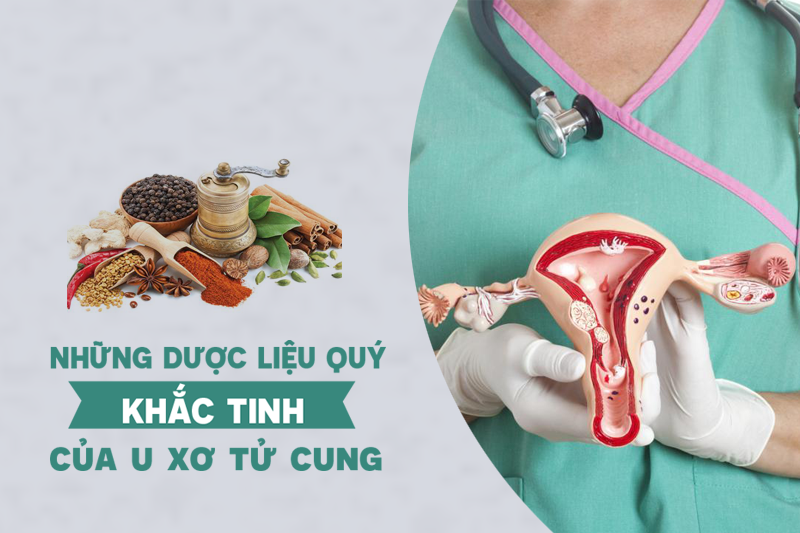 Những dược liệu quý - “khắc tinh” của u xơ tử cung
