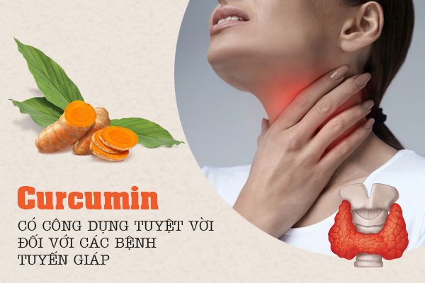 Tác dụng curcumin trong phòng và đẩy lùi các bệnh tuyến giáp