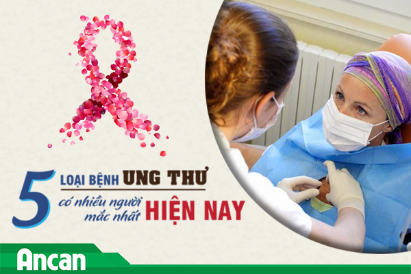 5 loại bệnh ung thư có nhiều người mắc và tử vong nhất hiện nay