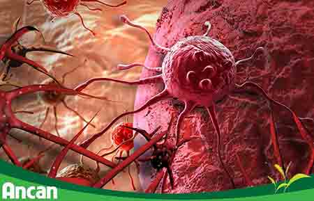 3 nguyên tắc vàng giúp bạn ngăn chặn sự hình thành khối u trong cơ thể