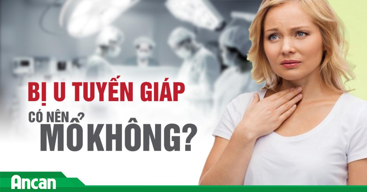 U tuyến giáp có nên mổ không?
