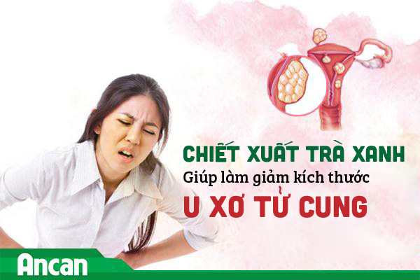 Tác dụng của trà xanh với bệnh u xơ tử cung