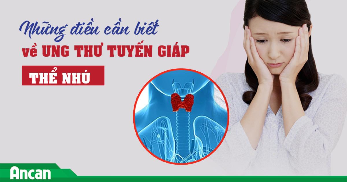 Những điều cần biết về ung thư tuyến giáp thể nhú