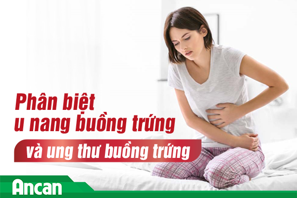 Phân biệt u nang buồng trứng và ung thư buồng trứng