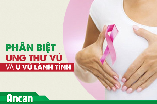Phân biệt ung thư vú và u vú lành tính