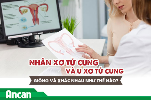 Nhân xơ tử cung và u xơ tử cung giống và khác nhau như thế nào?