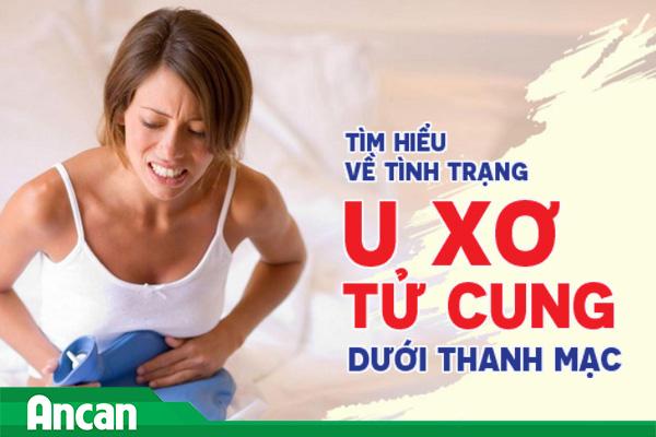 Tìm hiểu về tình trạng u xơ tử cung dưới thanh mạc