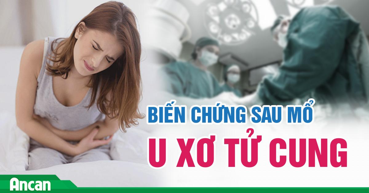 Những biến chứng thường gặp khi mổ u xơ tử cung