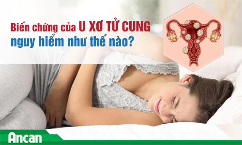 Biến chứng của bệnh u xơ tử cung nguy hiểm như thế nào?
