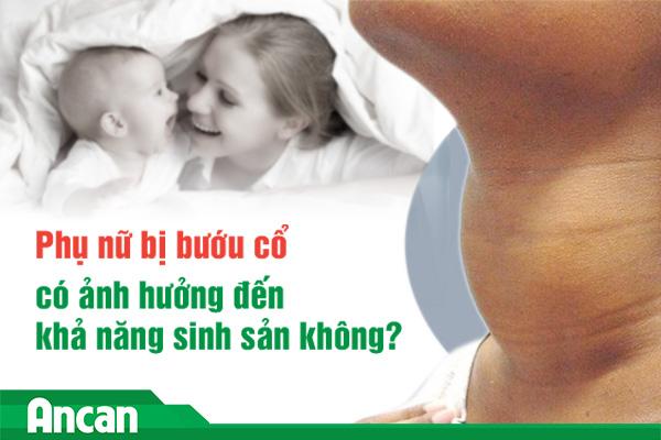 Phụ nữ bị bướu cổ có ảnh hưởng đến khả năng sinh sản không?