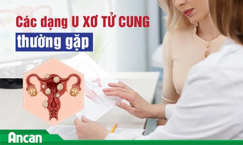 Bệnh u xơ tử cung và các dạng thường gặp